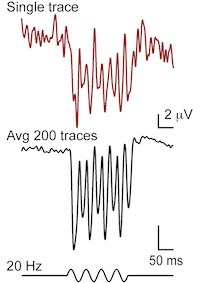 Microphonics